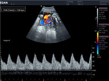 Cargar imagen en el visor de la galería, EDAN ACCLARIX LX8 - ULTRASONIDO DE CONSOLA DOPPLER COLOR - 3D/4D