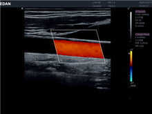 Cargar imagen en el visor de la galería, EDAN LX9 ULTRASONIDO INTELIGENTE DE CONSOLA 3D - 4D - 5D