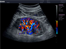 Cargar imagen en el visor de la galería, EDAN ACCLARIX LX8 - ULTRASONIDO DE CONSOLA DOPPLER COLOR - 3D/4D