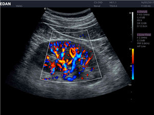 EDAN ACCLARIX LX8 - ULTRASONIDO DE CONSOLA DOPPLER COLOR - 3D/4D