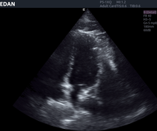 Cargar imagen en el visor de la galería, EDAN ACCLARIX LX8 - ULTRASONIDO DE CONSOLA DOPPLER COLOR - 3D/4D