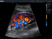 Cargar imagen en el visor de la galería, EDAN ACCLARIX LX8 - ULTRASONIDO DE CONSOLA DOPPLER COLOR - 3D/4D