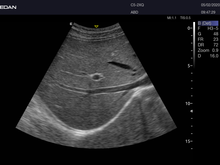 Cargar imagen en el visor de la galería, EDAN ACCLARIX LX8 - ULTRASONIDO DE CONSOLA DOPPLER COLOR - 3D/4D