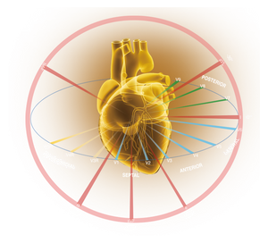 EDAN SE-18 - ELECTROCARDIOGRAMA DE 18 DERIVACIONES