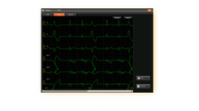 Cargar imagen en el visor de la galería, EDAN SE-18 - ELECTROCARDIOGRAMA DE 18 DERIVACIONES