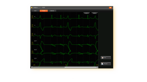 EDAN SE-18 - ELECTROCARDIOGRAMA DE 18 DERIVACIONES