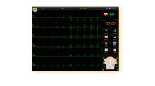 Cargar imagen en el visor de la galería, EDAN SE-18 - ELECTROCARDIOGRAMA DE 18 DERIVACIONES